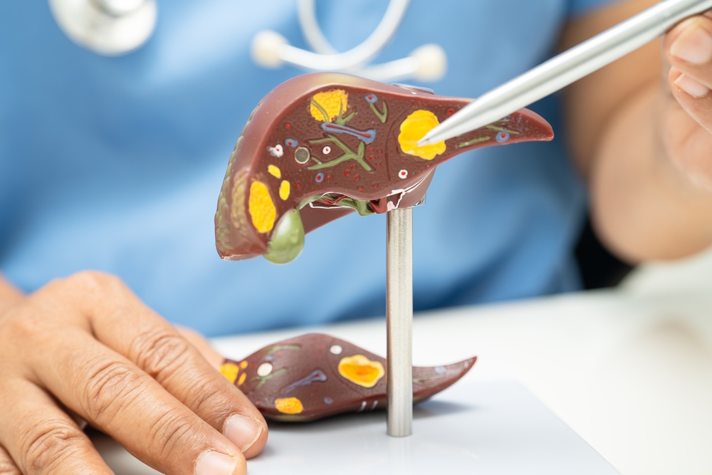 Fatty Liver Disease