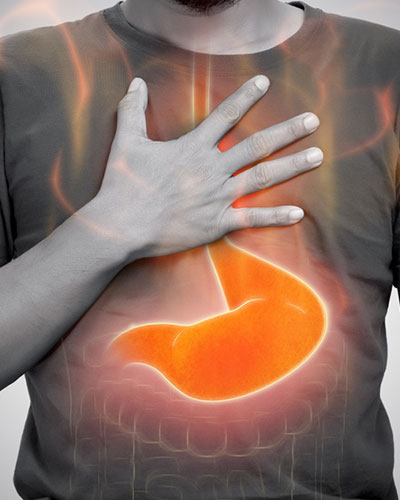 GERD Treatment in Vijayawada