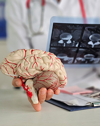 Neurology